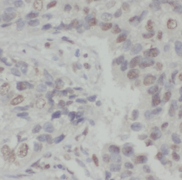 S100A16 antibody|S100A16抗体