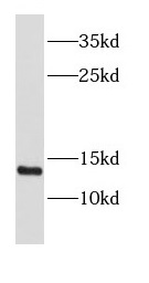 DDT antibody|DDT抗体