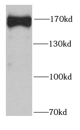 SAFB2 antibody|SAFB2抗体