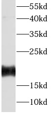 FGF12 antibody|FGF12抗体 FNab030