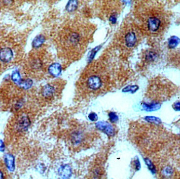 TSPAN33 antibody|TSPAN33抗体