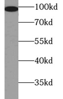 CTNNB1 antibody|CTNNB1抗体 FNab0