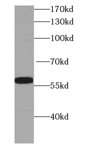 KMO antibody|KMO抗体 FNab04669