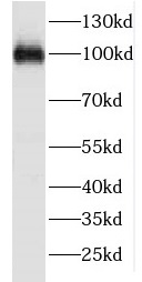 FSD2 antibody|FSD2抗体