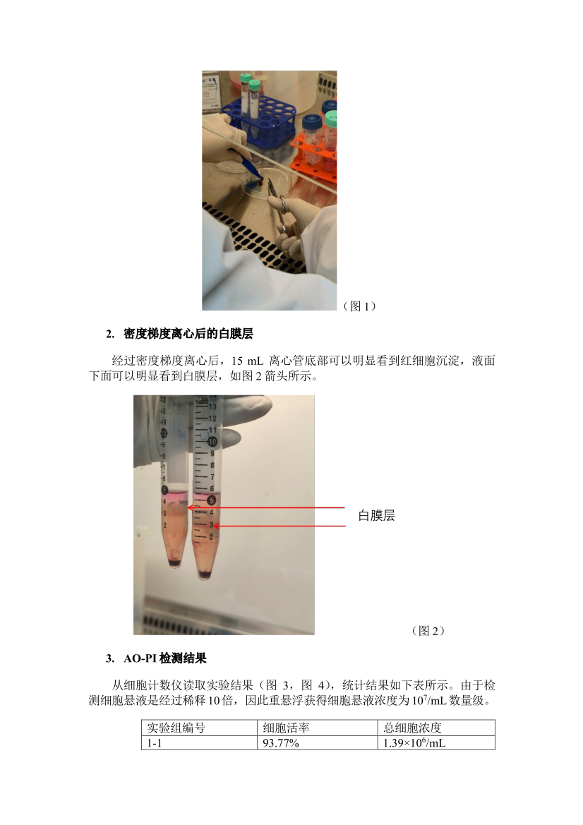 组织解离仪应用之无酶解离小鼠脾脏