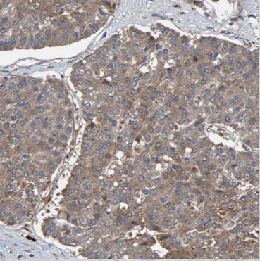 CNKSR1 antibody|CNKSR1抗体