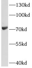 LOXL1 antibody|LOXL1抗体