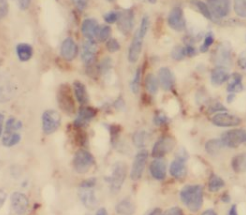 SYT4 antibody|SYT4抗体 FNab08430