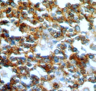 GCNT2 antibody|GCNT2抗体