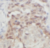 THRSP antibody|THRSP抗体