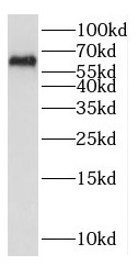NDOR1 antibody|NDOR1抗体