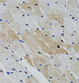 PTPN11 antibody|PTPN11抗体 FNab0