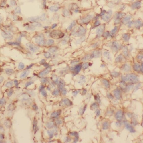 TMOD2 antibody|TMOD2抗体