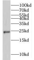LAPTM4B antibody|LAPTM4B抗体