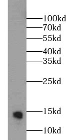 LY6D antibody|LY6D抗体