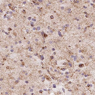 CHST10 antibody|CHST10抗体