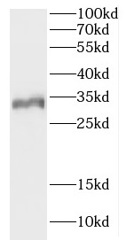 CCDC28B antibody|CCDC28B抗体