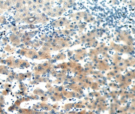 SAA2 antibody|SAA2抗体