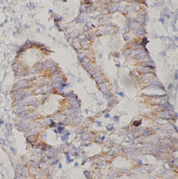 PAX5 antibody|PAX5抗体