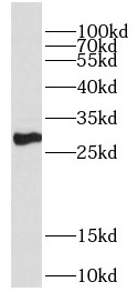 DECR2 antibody|DECR2抗体