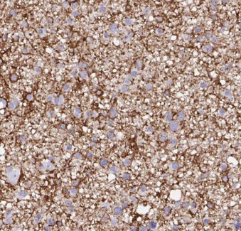 C9orf72 antibody|C9orf72抗体 FNa