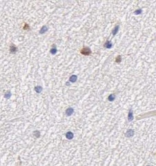 GP repeat antibody|GP repeat抗体