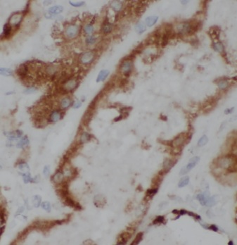 MRPS17 antibody|MRPS17抗体