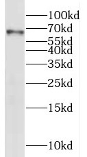 PPP4R2 antibody|PPP4R2抗体
