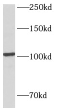 AMPD2 antibody|AMPD2抗体