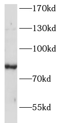 ANKRD6 antibody|ANKRD6抗体