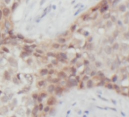 HSPA1A antibody|HSPA1A抗体 FNab0