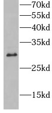 HLA-DQB1 antibody|HLA-DQB1抗体