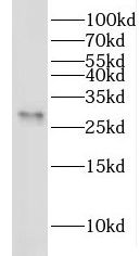 YEATS4 antibody|YEATS4抗体