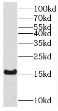 ACOT13 antibody|ACOT13抗体