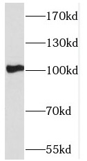 PCDHA5 antibody|PCDHA5抗体