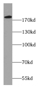 DOCK1-Specific antibody|DOCK1抗