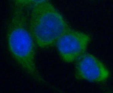 ACACA antibody|ACACA抗体