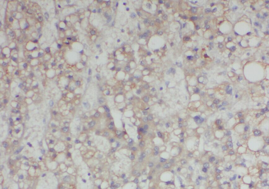 AADAT antibody|AADAT抗体