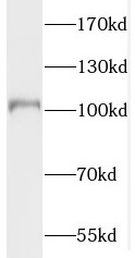 PDE6A antibody|PDE6A抗体