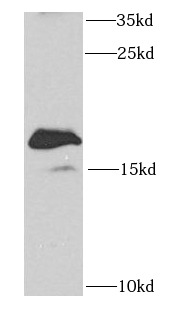 SAP18 antibody|SAP18抗体