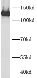 AXL antibody|AXL抗体