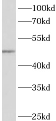 ACTL7A antibody|ACTL7A抗体