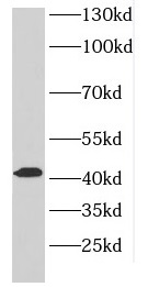DLK2 antibody|DLK2抗体