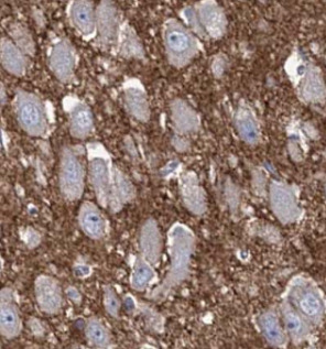 SYP antibody|SYP抗体 FNab08421