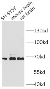 NEFL antibody|NEFL抗体 FNab05710