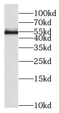 RIOX2 antibody|RIOX2抗体