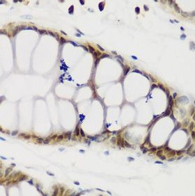 NCL antibody|NCL抗体