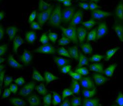 TPI1 antibody|TPI1抗体 FNab08886