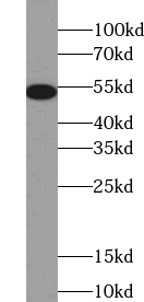 TSP50 antibody|TSP50抗体