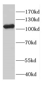 CNTN4 antibody|CNTN4抗体